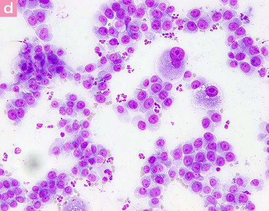 図7. 猫の乳腺癌の細胞診画像 d