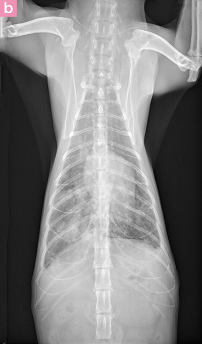 図10. 肺転移をともなう乳腺癌の胸部X線画像（び漫性気管支間質パターン） b
