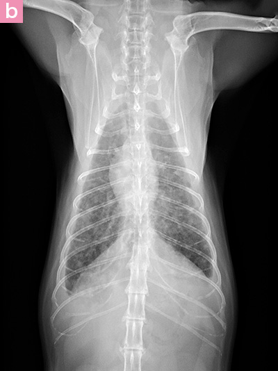 図8. 胸骨リンパ節および肺転移をともなう乳腺癌の胸部X線画像 b